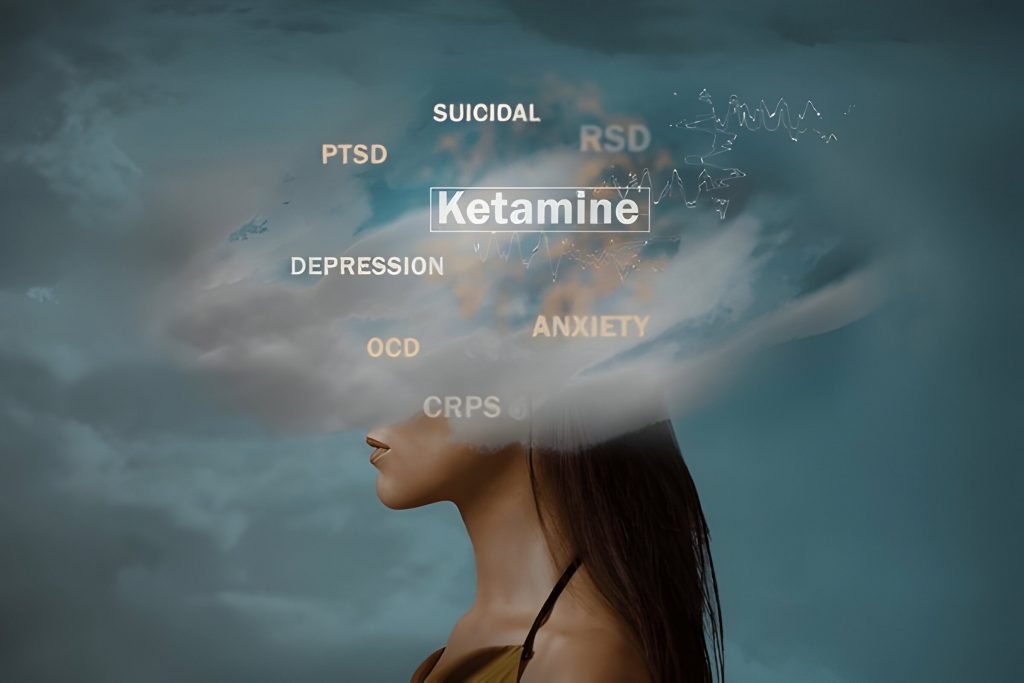 Who Is a Good Candidate for Ketamine Treatment